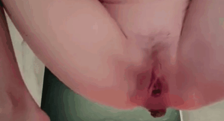 青少年女孩排便和涂抹